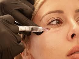 Mesotherapy microinjections applied across scalp
