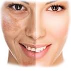 Dermatologist examining pigmentation on a patient's cheek