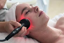 Radiofrequency tightening device treating jawline